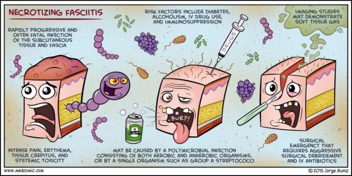 Fasciitis necrotizing skin infections