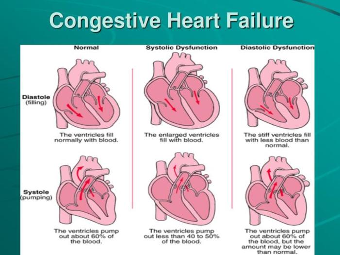 Hesi case study congenital heart disease