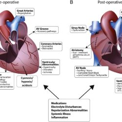 Interventional paradigm changing