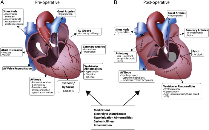 Interventional paradigm changing