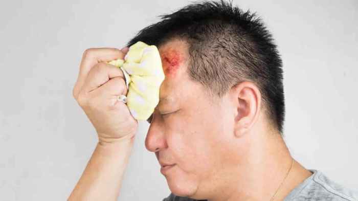 A person with a severe head injury subsequent acts irresponsibly